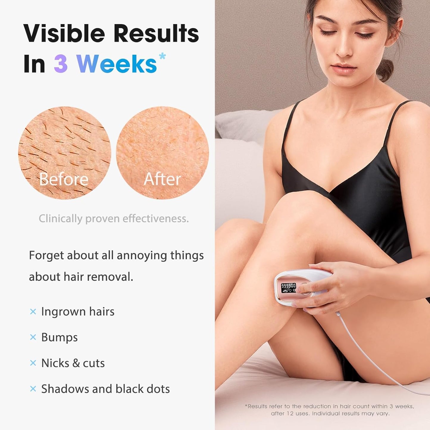 SmoothSkin IPL Hair Remover